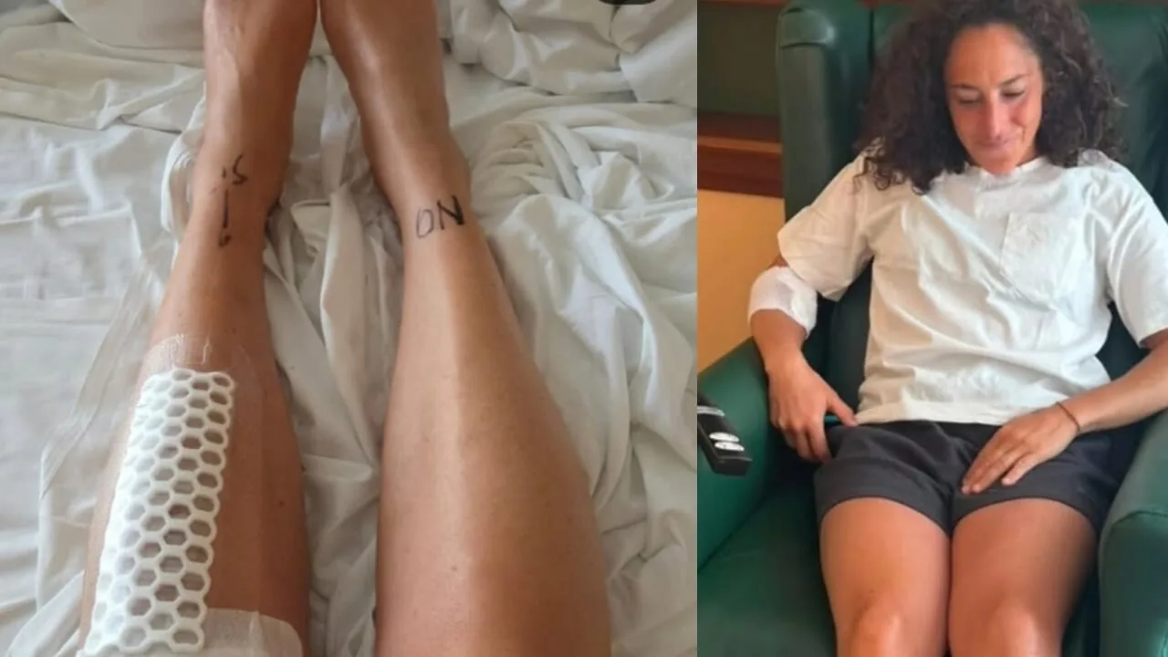 Brignone mostra il ginocchio operato e la placca rimossa, poi rassicura: "Sto bene, avrò qualche giorno in stampelle"